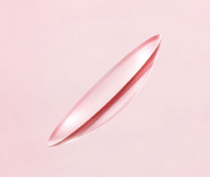 メニコンティニュー